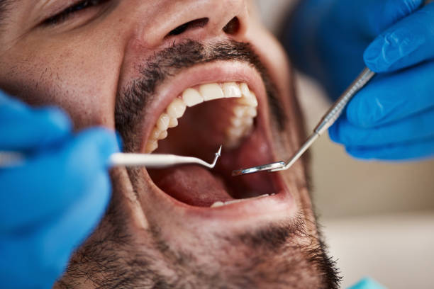 Best Broken Tooth Emergency  in Big Bass Lake, PA